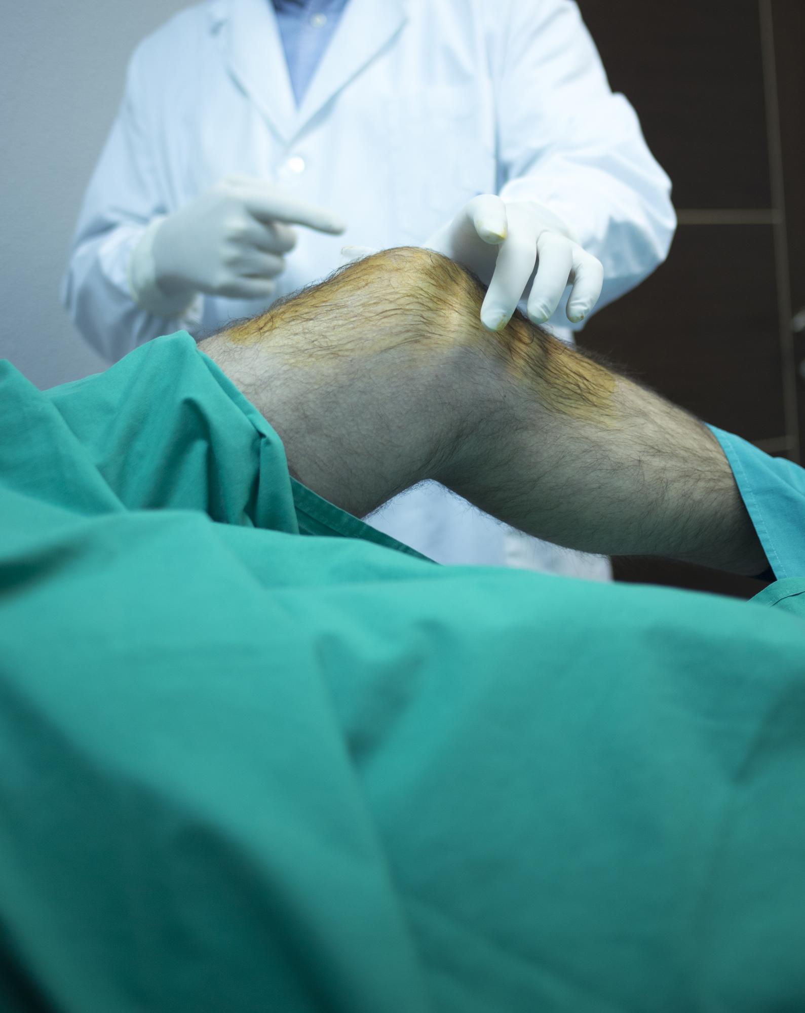 best-ACL-Reconstruction-surgery-in-india