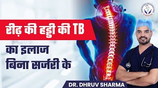 Spinal Tuberculosis Symptoms, Diagnosis, Treatment, and Recovery Explained in Detail by Dr. Dhruv Sharma (Best Spine Surgeon in DelhiFaridabadUttar PradeshIndia))