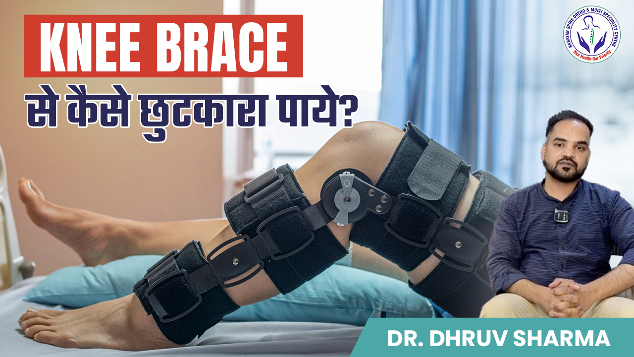 Knee Braces After Knee Surgery: When to Use and When to Remove?